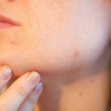 Zašto nas koža više svrbi kad ostarimo? 13