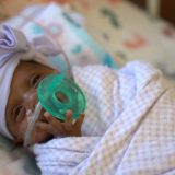 Najmanja prerano rođena beba na svetu puštena iz bolnice u Americi 5