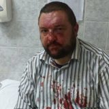 DS: Pretučen odbornik, jedan od organizatora protesta u Knjaževcu 1