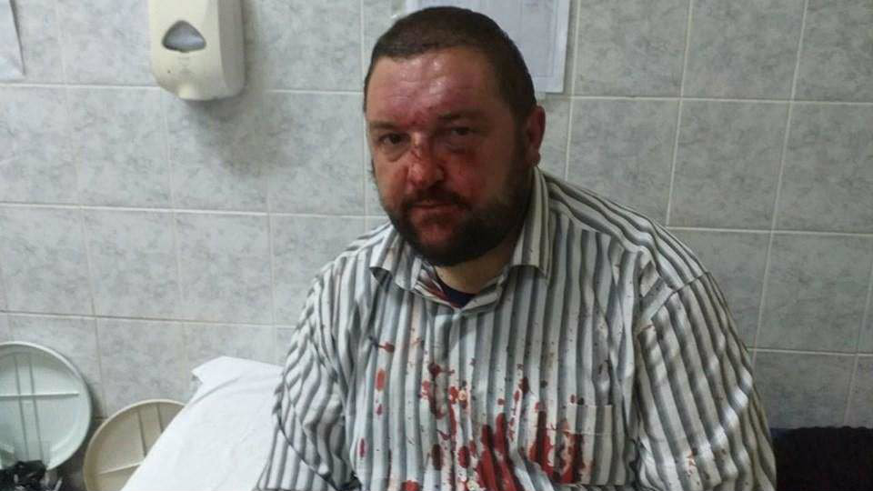 DS: Pretučen odbornik, jedan od organizatora protesta u Knjaževcu 1