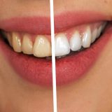 Kаriјеs u svеtu imа 2,4 miliјаrdе ljudi 15