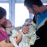 Hrvatski lekari razdvojili sijamske blizance 2