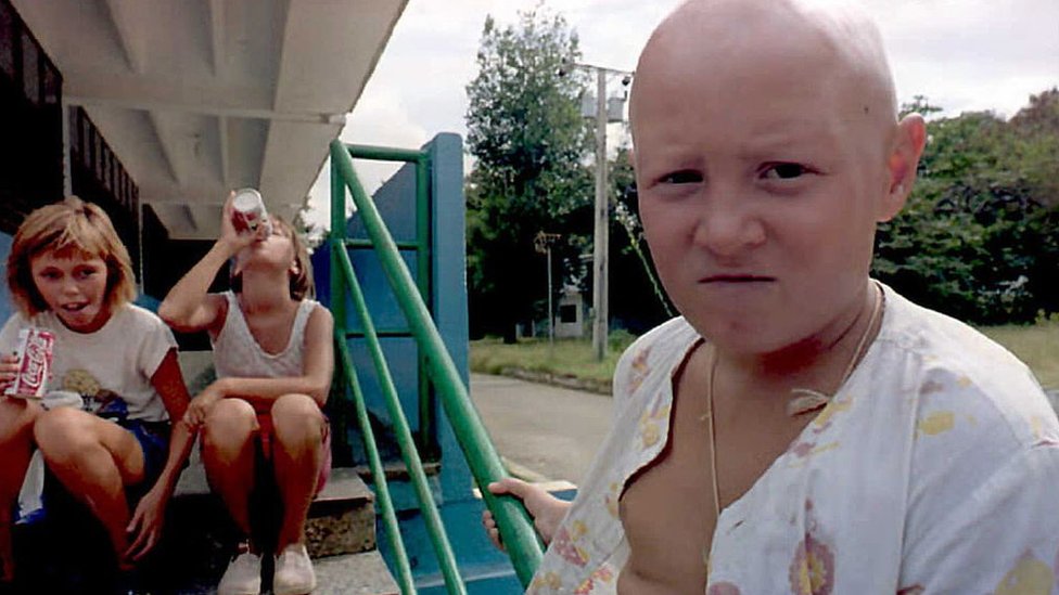 Chernobyl kids