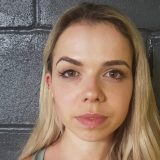 Silikoni u grudima: Žene moraju da znaju šta sve može da im se desi 5