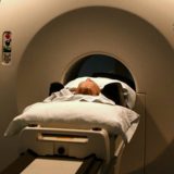 CT kolonografija - kako izgleda i čemu služi pregled? 9