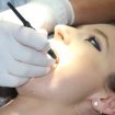 U Srbiji čak 700.000 građana nema nijedan zub: Da li postoji plomba koja bi pokrila problem u srpskoj stomatologiji? 16
