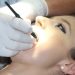 ČETVRTAK U Srbiji čak 700.000 građana nema nijedan zub: Da li postoji plomba koja bi pokrila problem u srpskoj stomatologiji? 13
