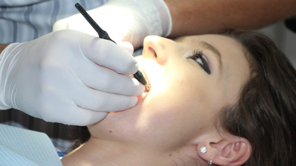 Put do precizne stomatološke dijagnoze - snimanje zuba 2
