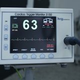 Šta sve može da otkrije ehokardiografski pregled? 8