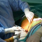 U Skoplju uspešno urađena prva transplantacija srca 7