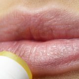 Ugradnja silikona u usne - komplikacije i kako ga se rešiti? 1