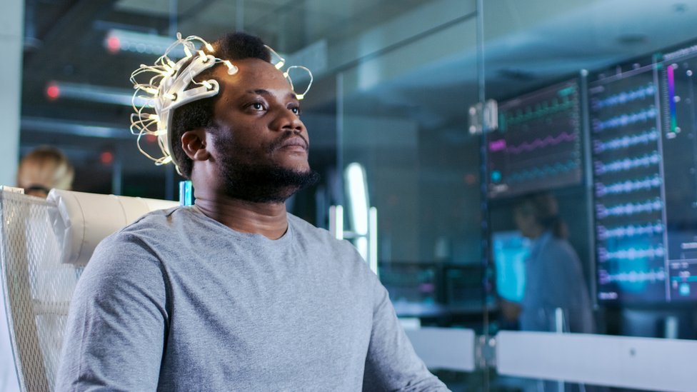 Precizna stimulacija nervnih ćelija poboljšava pamćenje 1 Elektronska stimulacija mozga