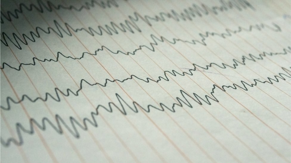 Precizna stimulacija nervnih ćelija poboljšava pamćenje 2 Moždani talasi