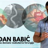 Nova operacija potpuno sprečava moždani udar 7