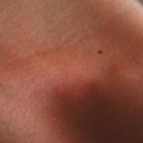 Kako proveriti mladež? 4