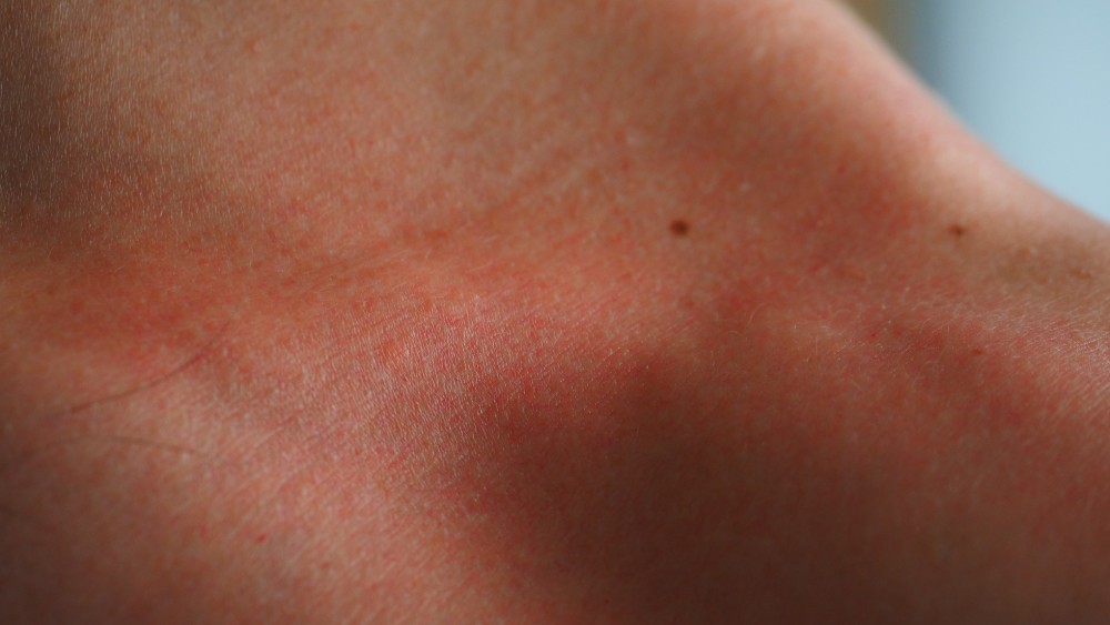 Kako proveriti mladež? 1