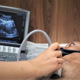 U Srbiji se žene sve kasnije odlučuju na rađanje, prvo dete sa 28 godina 6