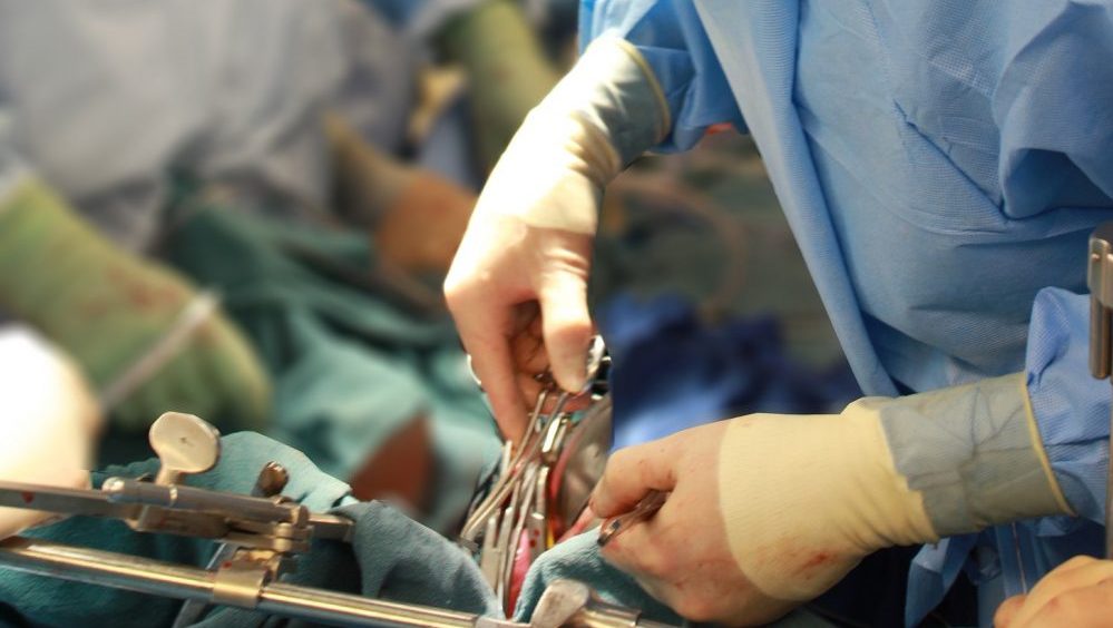Istorijski podvig srpskih kardiohirurga – pacijentu ugrađena dva veštačka srca 11