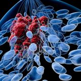 Naučnici ispituju delotvornost postojećeg leka u lečenju metastaznog karcinoma dojke 3