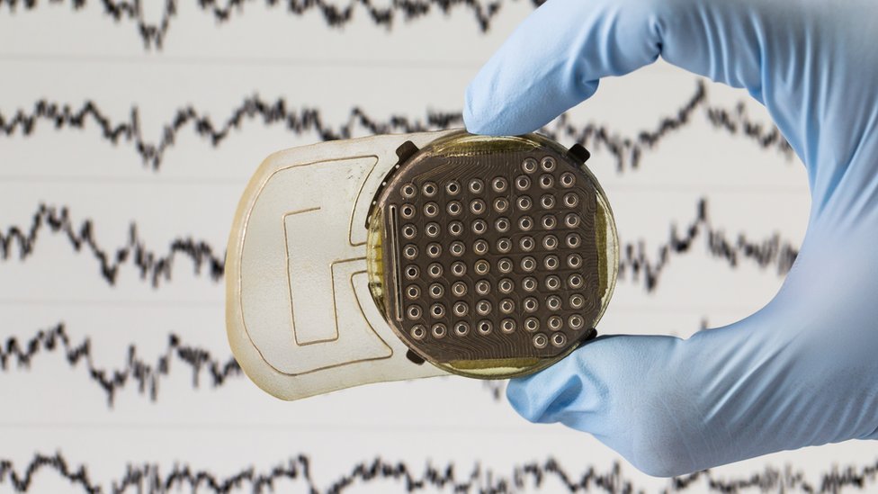 Sensors read brain activity