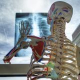 Pregled za otkrivanje osteoporoze koji se ne preporučuje trudnicima 11