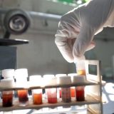 U Srbiјi živi 2.756 оsоbа kојimа је diјаgnоstikоvаn HIV 7