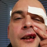 Vučević se pomirio s napadačima: Prihvatam pruženu ruku 6