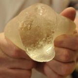 BIRN: Problematični implanti i u Srbiji 1