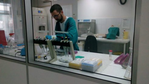 Produžena ruka transplantacije (FOTO) 5