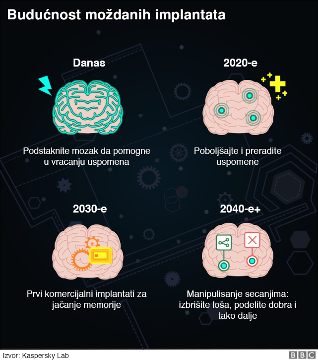 Hakeri bi ubuduće mogli da nam rade o mozgu - bukvalno 3 grafika moždanih implantata