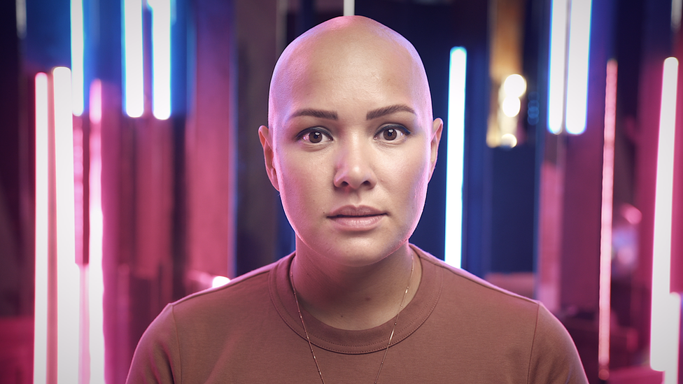 Ćelava i hrabra: Maltretirali su me zbog izgleda, sada pomažem drugima 1 Lilija Kukuškina-Nugmanova