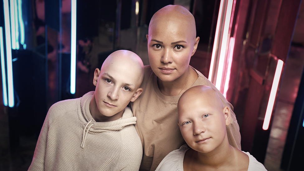 Ćelava i hrabra: Maltretirali su me zbog izgleda, sada pomažem drugima 5 Lilija kaže da ju je rad u grupama za podršku obolelima od alopecije inspirisao da postane socijalna radnica