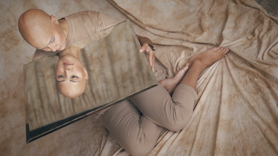 Ćelava i hrabra: Maltretirali su me zbog izgleda, sada pomažem drugima 4 Lilija takođe upozorava da ljudi ne smeju da se podvrgavaju lečenju gubitka kose bez znanja lekara