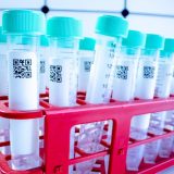 Korona virus - najčešća pitanja: Treba li uzimati brufen i koliko virus opstaje u vazduhu 6