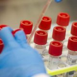 FDA odobrila primenu hlorokvina i hidroksihlorokvina kod obolelih od korona virusa 3