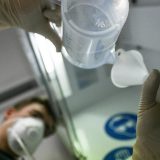 CINS objavio podatke o broju respiratora 6