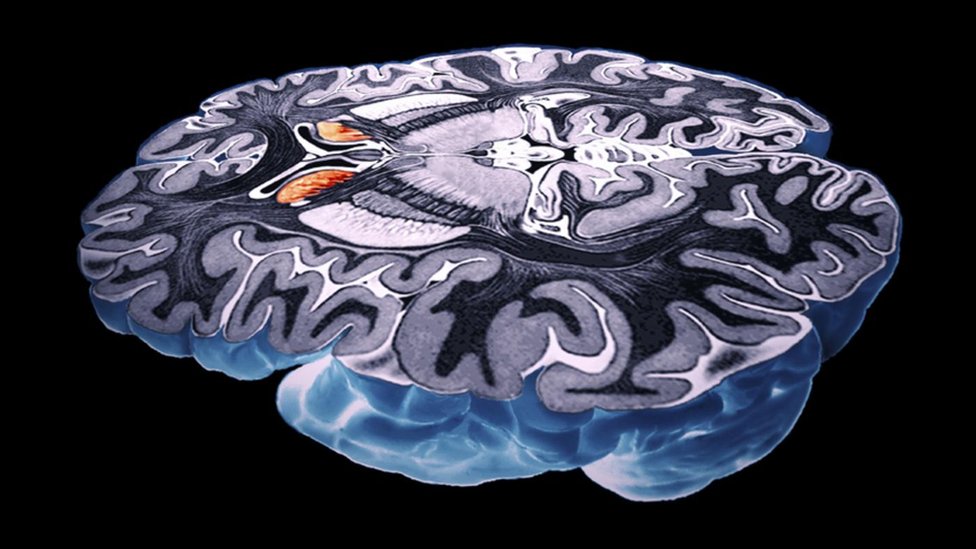 Čudesni mozak simultanih prevodilaca - kako se istovremeno misli na dva jezika 2 mozak