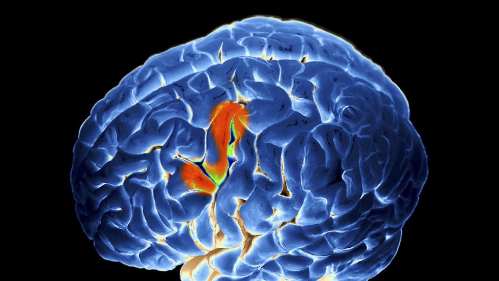 Čudesni mozak simultanih prevodilaca - kako se istovremeno misli na dva jezika 4 mozak