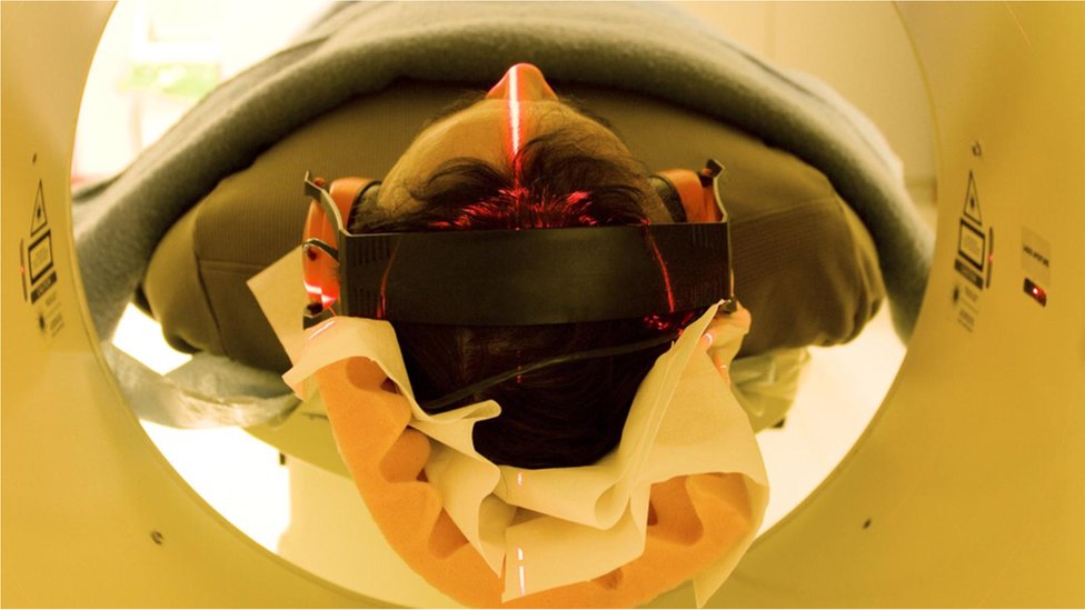 Čudesni mozak simultanih prevodilaca - kako se istovremeno misli na dva jezika 6 skener