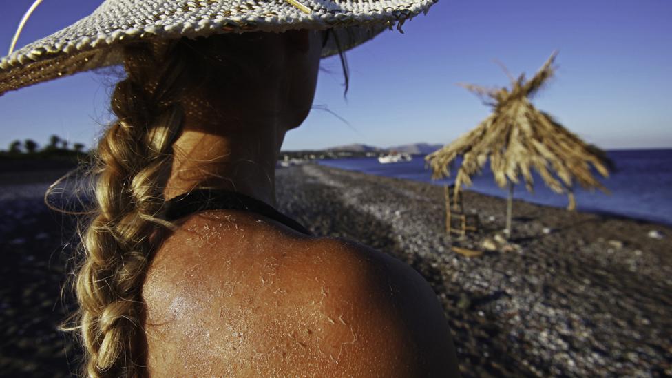UV zračenje i dezinfekcija: Može li se korona virus uništiti UV zracima 2 sunčanje koža