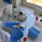 Dvostruko više novoobolelih u Vojvodini 5