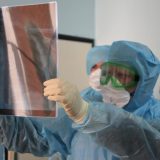 U KC Vojvodina od korona virusa leči se 60 pacijenata, u Pančevu 94 6