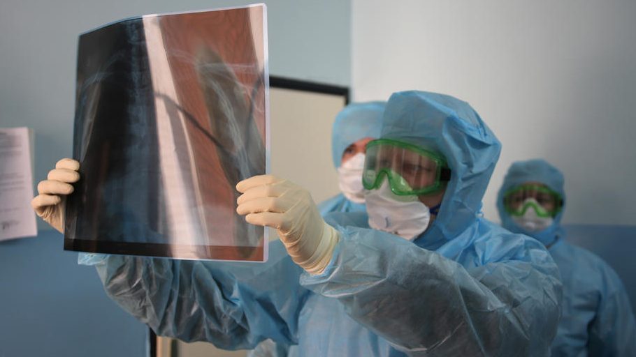 U KC Vojvodina od korona virusa leči se 60 pacijenata, u Pančevu 94 1