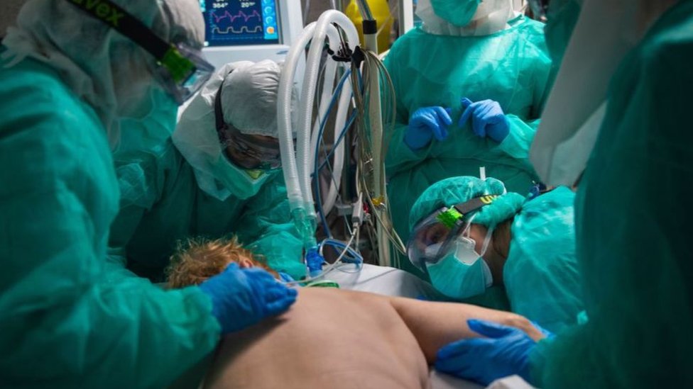 Korona virus: Šta je „proning“ i zašto premeštanje pacijenata potrbuške može da im spasi živote 1 Medical team dealing with a patient in prone position