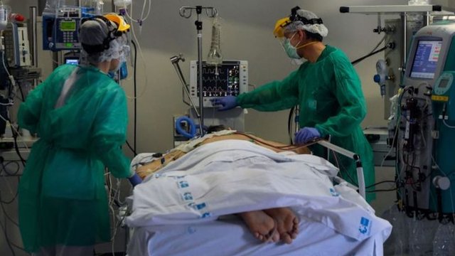 Korona virus: Šta je „proning“ i zašto premeštanje pacijenata potrbuške može da im spasi živote 3 Medical team dealing with a patient in prone position