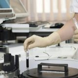 Bum privatnih testova na korona virus u Beču 1