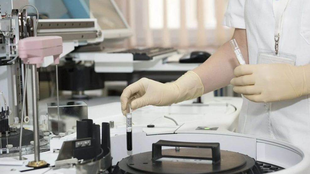 Bum privatnih testova na korona virus u Beču 1