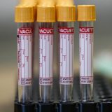 Stojanović: Antitela vrh ledenog brega našeg imunog sistema 7