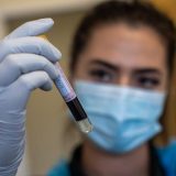 Kovid centar u Novom Sadu ukida noćno dežurstvo 6