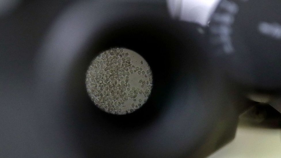 Korona virus i imunitet: Zagonetne T-ćelije možda pružaju skriveni imunitet na Kovid-19 4 T-ćelije mogu se zadržati u telu godinama nakon što infekcija prođe, obezbeđujući tako dugotrajnu memoriju imunskom sistemu